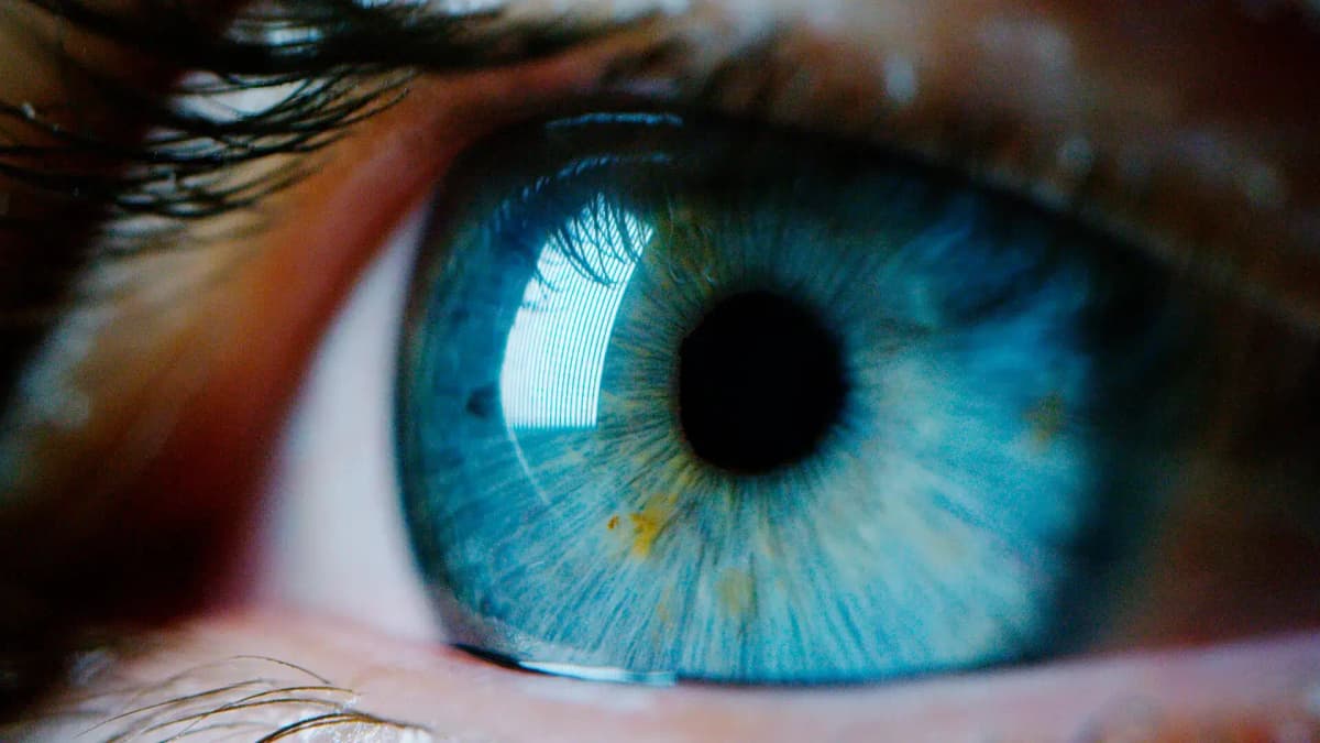 Herpes Zóster Oftálmico: ¿qué es y cuáles son sus síntomas?